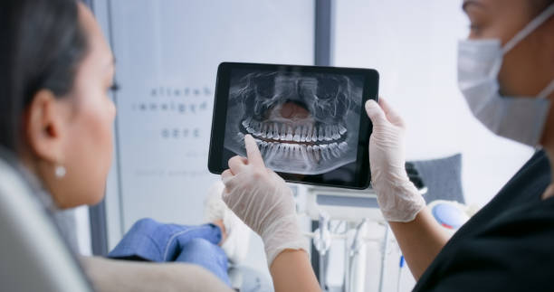 Licensed Dental Implants service in Frederick, MD - Smile Center Dentistry
