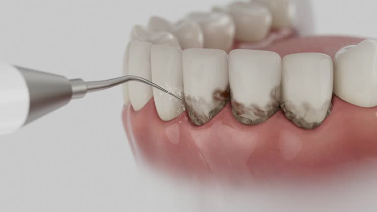 Reliable Dental Implants contractor in Frederick, MD by Smile Center Dentistry